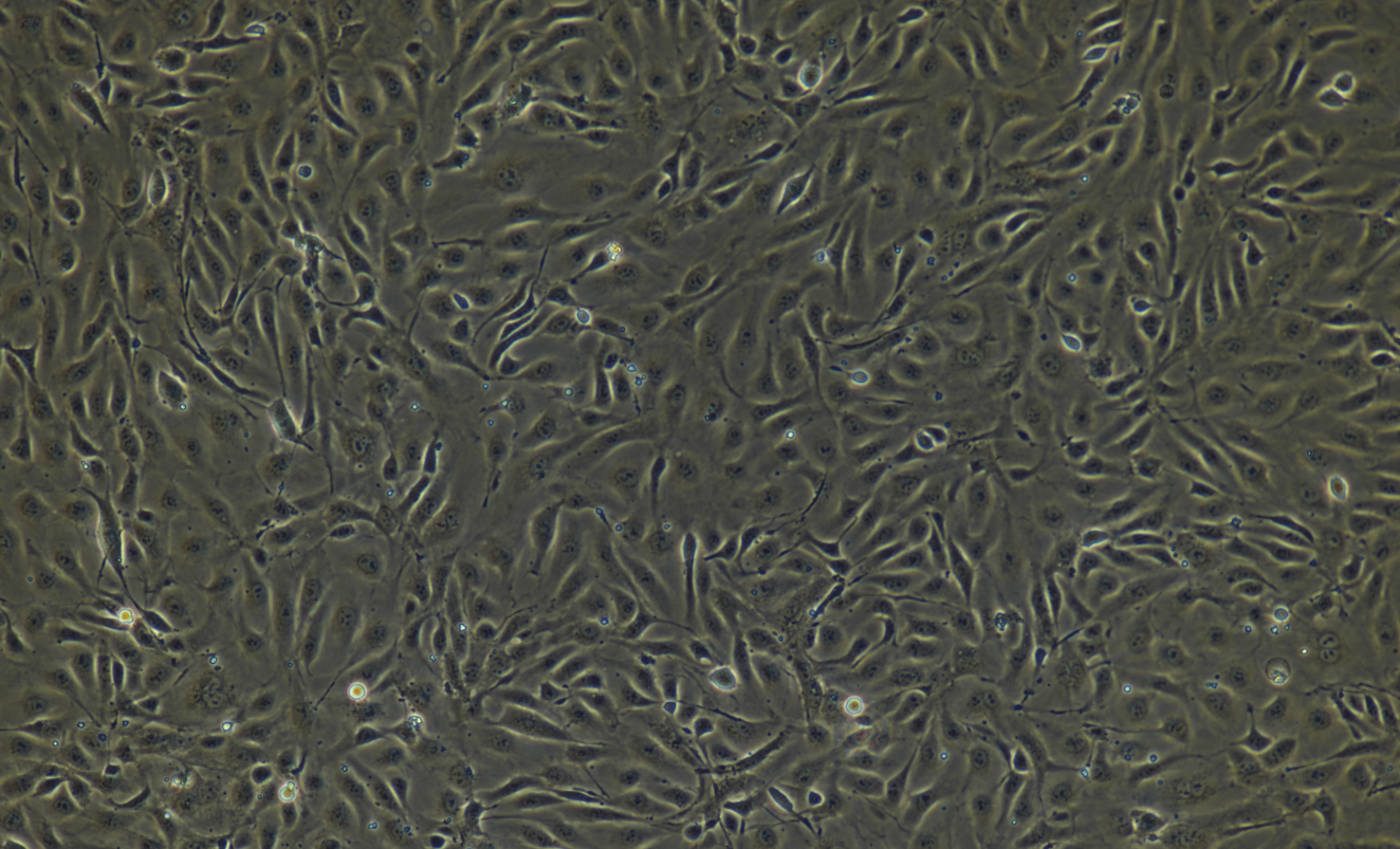 脐静脉内皮细胞/SD大鼠肝实质细胞/黑色素细胞/免疫荧光鉴定
