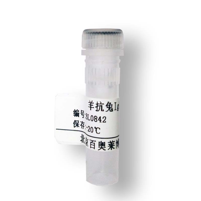 CYB161068型人血清IgM(液体)70～80%纯度,4mg&#x2f;ml浓度价格