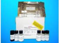 Chorionic Gonadotropin Beta Polypeptide (CGb) ELISA Kit, Human