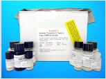 Ribonuclease T2 (Rnase-T2) ELISA Kit, Human