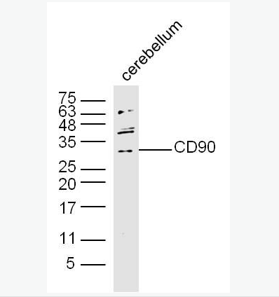 CD90抗体