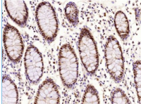 PCNA 增殖细胞核抗原抗体