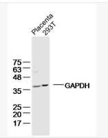 3-磷酸甘油醛脱氢酶单克隆抗体(内参抗体)