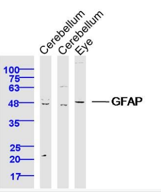 胶质纤维酸性蛋白抗体GFAP