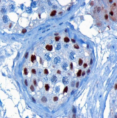 大鼠肝卵圆细胞HOC