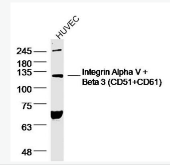 整合素αVβ3抗体免疫组化