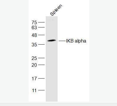 IKB alpha核因子κB抑制蛋白α抗体