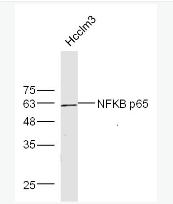英文名称NFKB p65细胞核因子/k基因结合核因子抗体