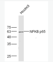 英文名称NFKB p65细胞核因子&#x2f;k基因结合核因子抗体