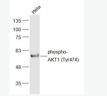 磷酸化蛋白激酶AKT1抗体