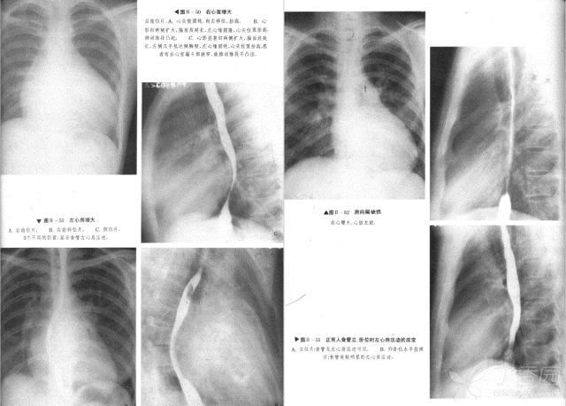 2018丁香园医学影像读片基础学习书籍(电子书