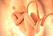 第四脑室脉络丛：早孕期胎儿后颅窝异常的新指标
