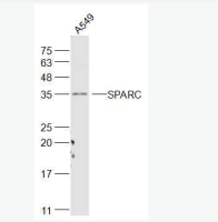 富含半胱氨酸的酸性分泌蛋白抗体SPARC