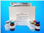 Factor-related Apoptosis, FAS ELISA Kit, Human