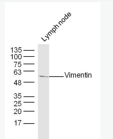 波形蛋白抗体Vimentin