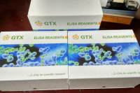 乙醛脱氢酶（ALDH）活性比色法试剂盒