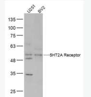 5-羟色胺受体2A抗体