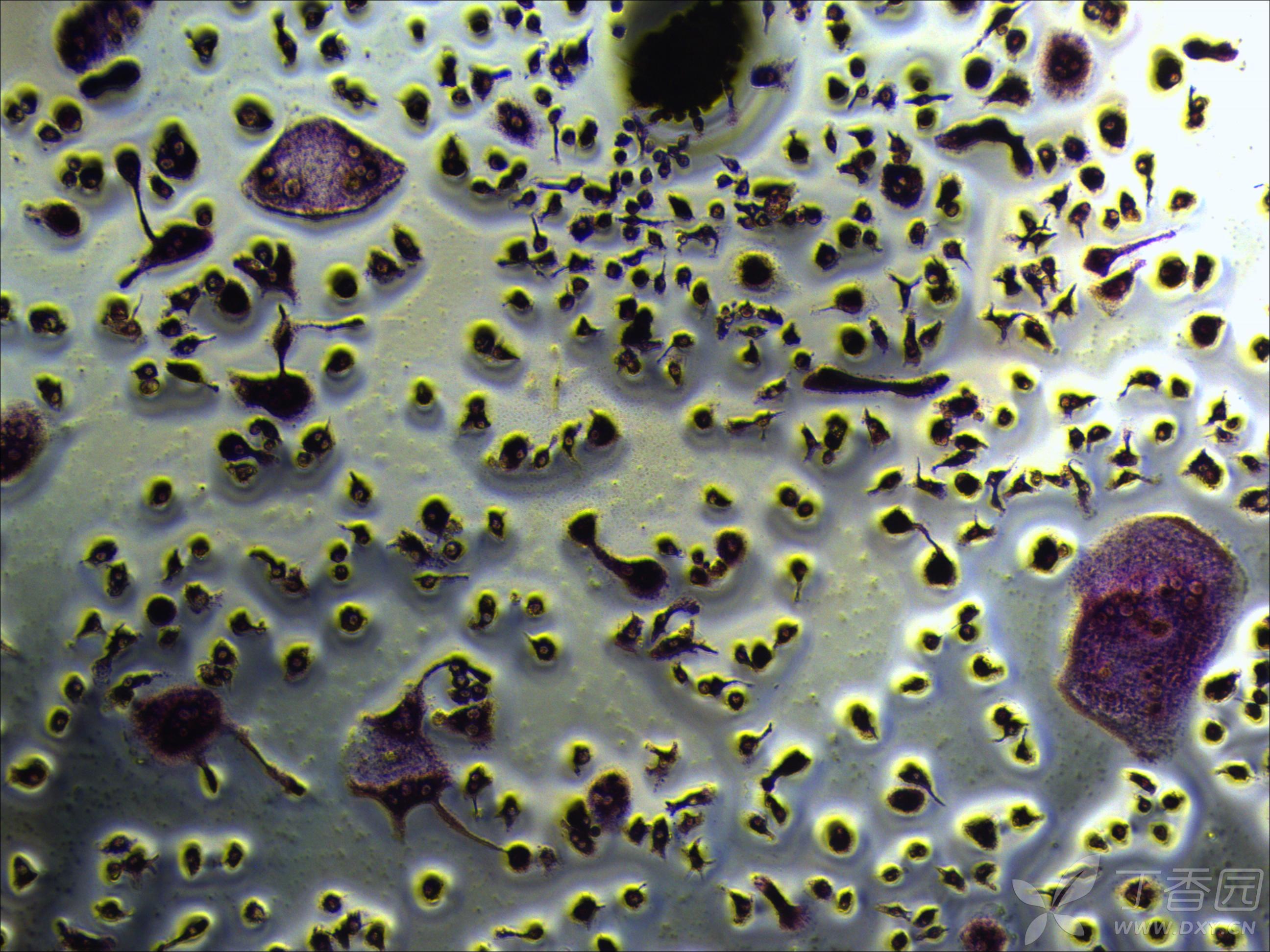 终于,你来了——我可爱的破骨细胞