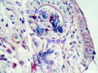 爱先蓝-糖原（AB-PAS）染液