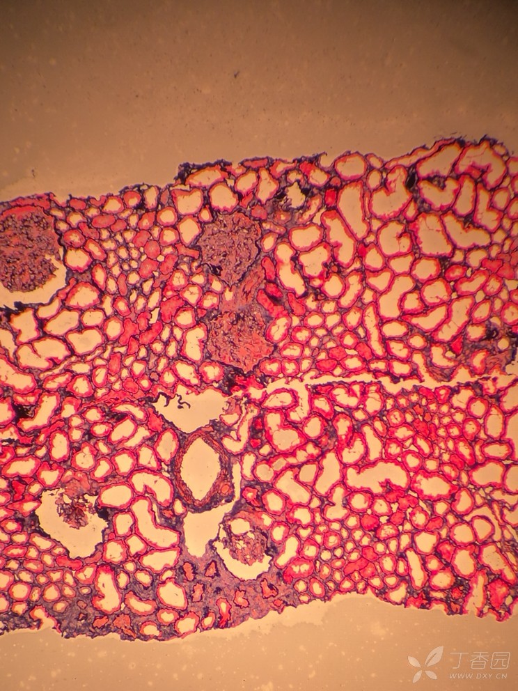 肾组织染色 select123 2018-04-13 09:52   关注      染色后如下