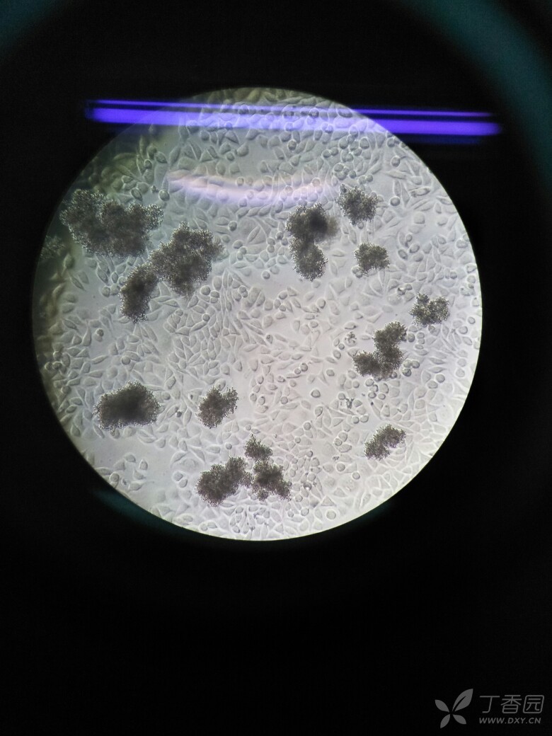 有大佬知道这l929细胞里漂的是什么?