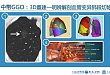 GGO 改良新技术，康复比阑尾手术还快