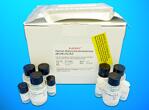 Heat shock protein beta-2 (HSPB2) ELISA kit, Human