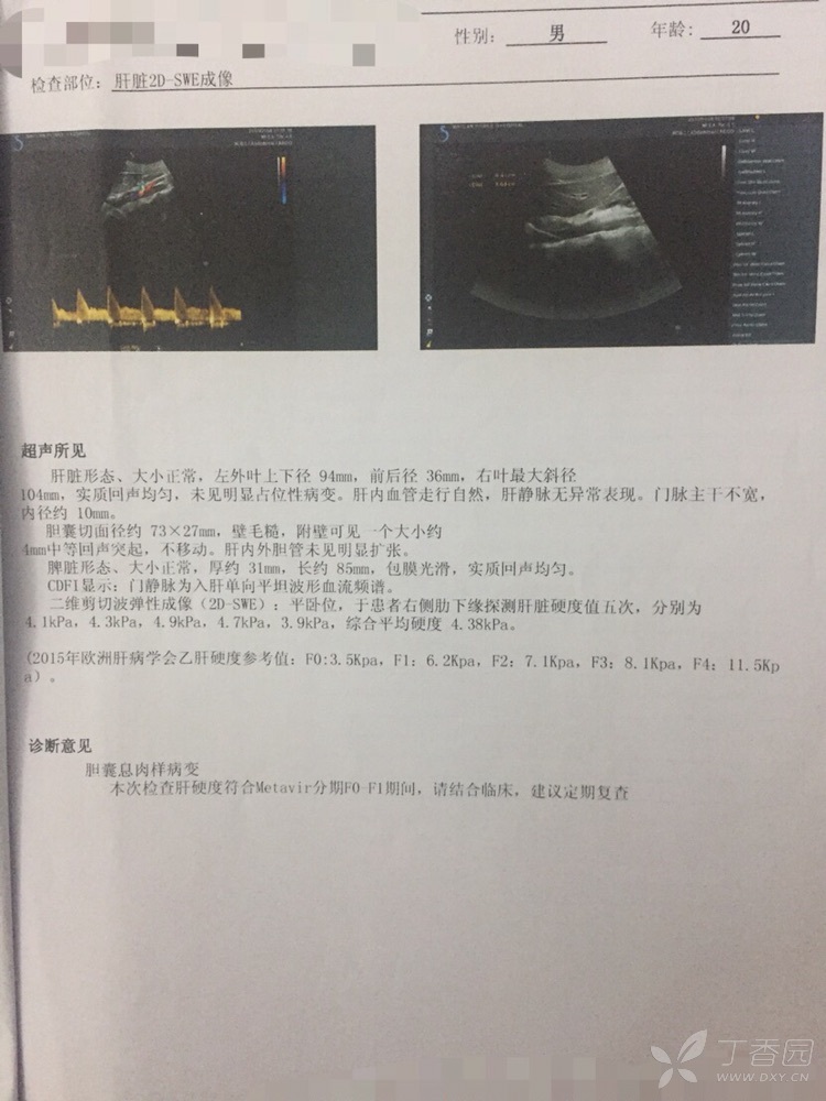 肝脏gdp高用啥药_肝脏位置(2)