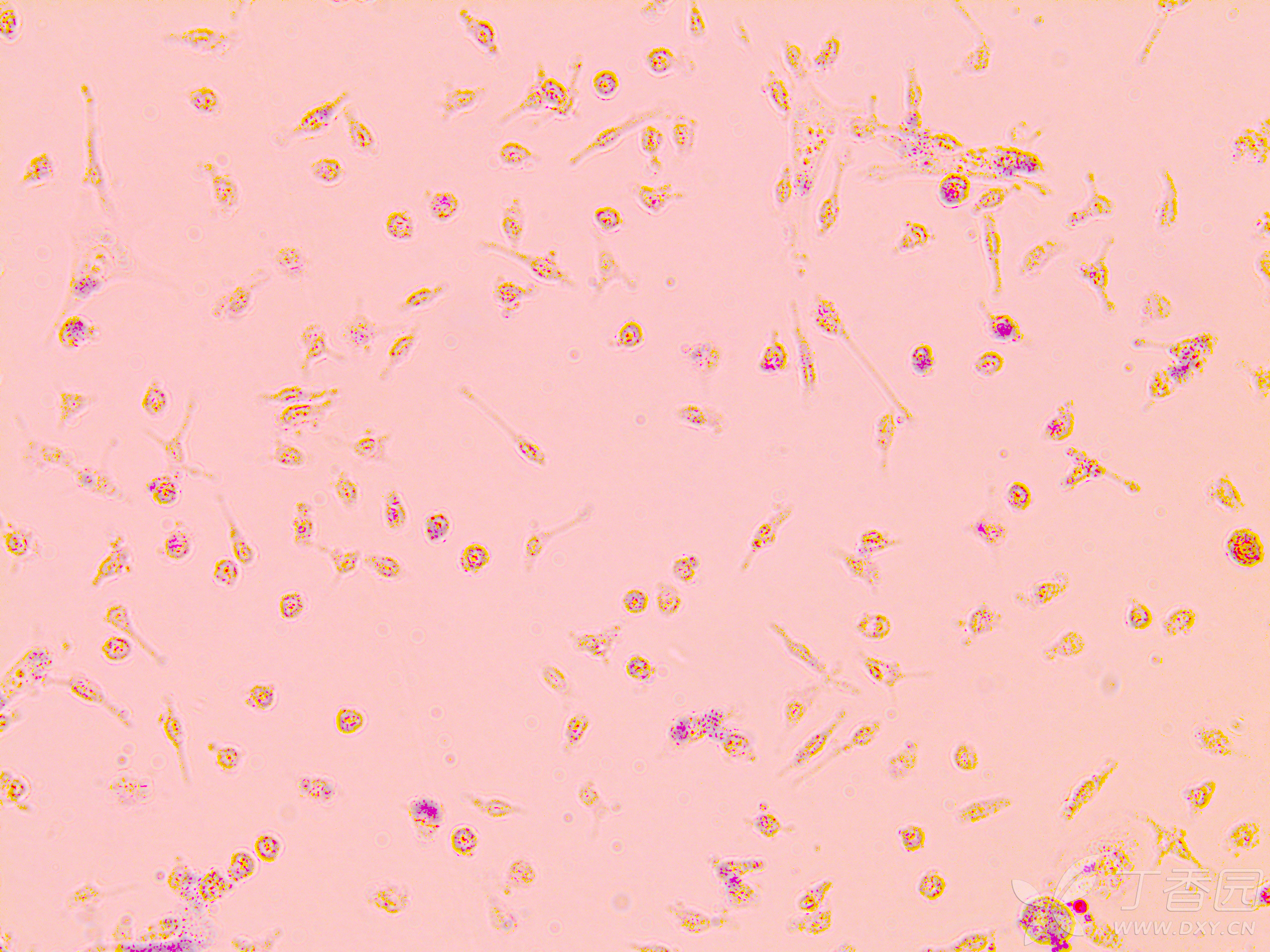 巨噬细胞泡沫化油红染色