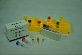 黄曲霉毒素M1检测试剂盒