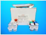 Acetyl Coenzyme A Carboxylase ELISA Kit (ACC), Human