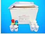 1-acyl-sn-glycerol-3-phosphate acyltransferase beta (AGPAT2) ELISA Kit, Human