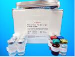 Acyl-CoA dehydrogenase family member 10 (ACAD10) ELISA Kit, Human
