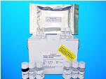 Anti-Intrinsic Factor Antibody ELISA Kit (AIFA), Human