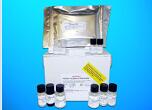 Anti-keratin antibody ELISA Kit (AKA), Human