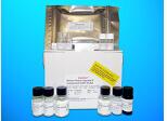 Anti-Insulin Receptor Antibody (AIRA) ELISA Kit, Human
