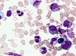 人Ph+急淋白血病细胞系；SUP-B15说明书
