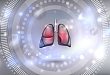 M 型超声如何鉴别不同类型心肺功能衰竭