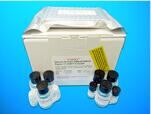 Coxsackie B Group of Mixed IgD Antibodies ELISA Kit, Human