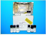 Choline acetylase ELISA Kit (CHAc), Human