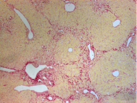 CCl4诱导性肝硬化模型