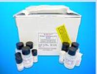 Chorionic Gonadotropin ELISA Kit (CG), Human