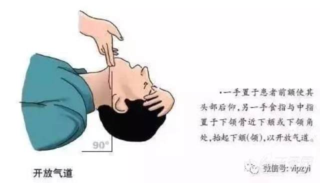 如果怀疑颈椎损伤要这样开放气道