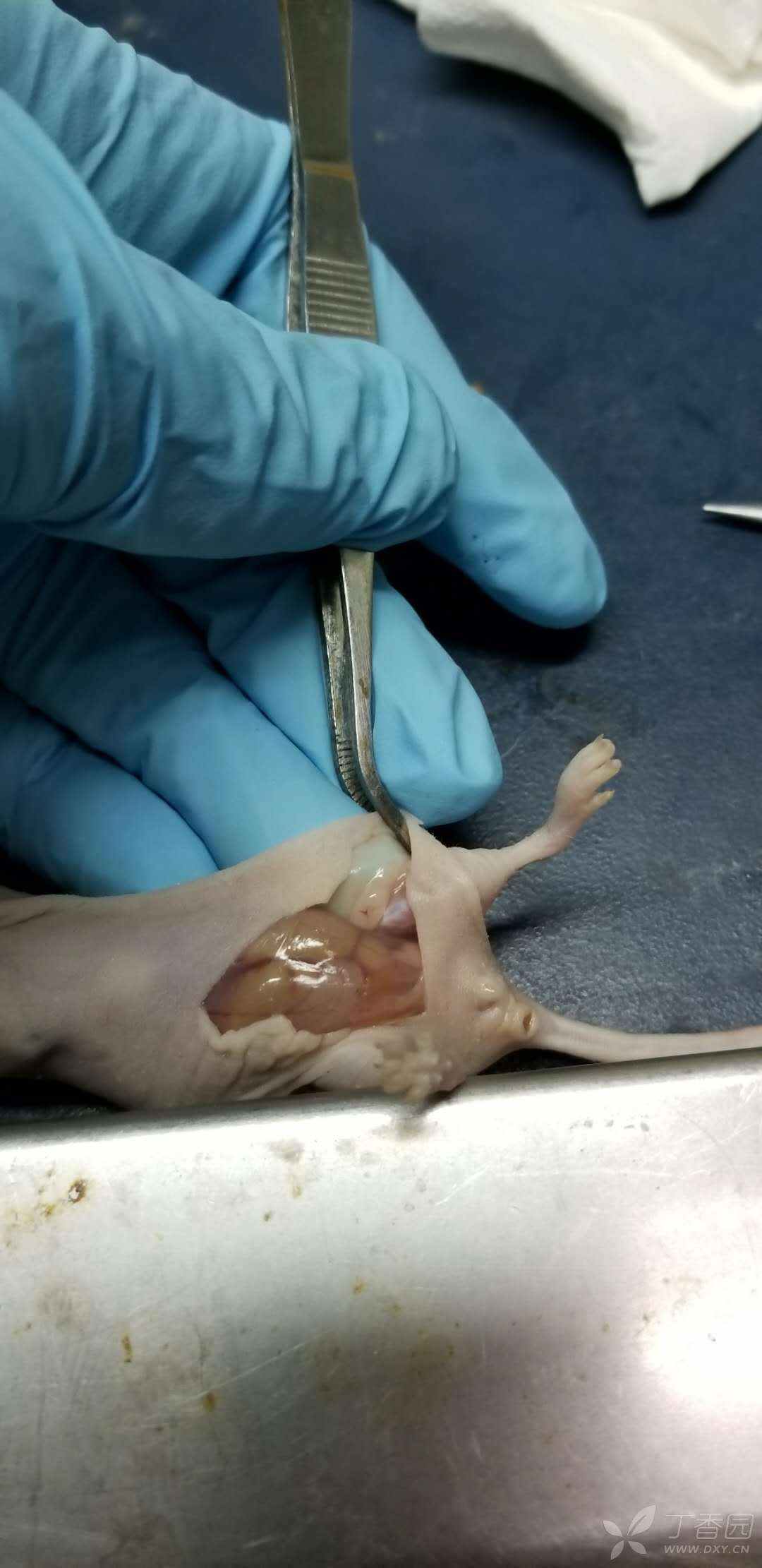 裸鼠乳腺癌,皮下脂肪垫成瘤 - 丁香园论坛