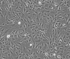人骨髓间充质干细胞，BMSC细胞