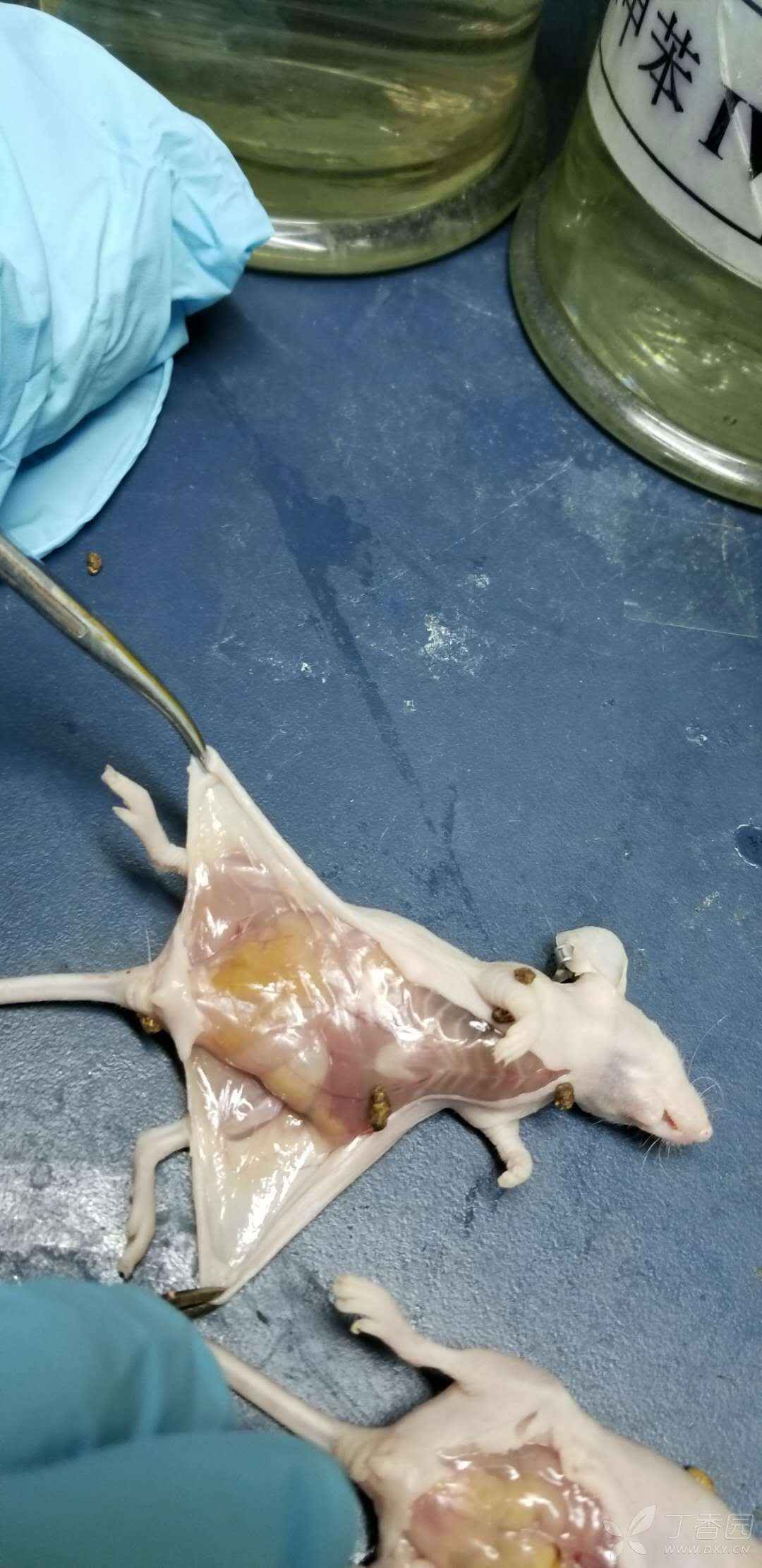 裸鼠乳腺癌,皮下脂肪垫成瘤