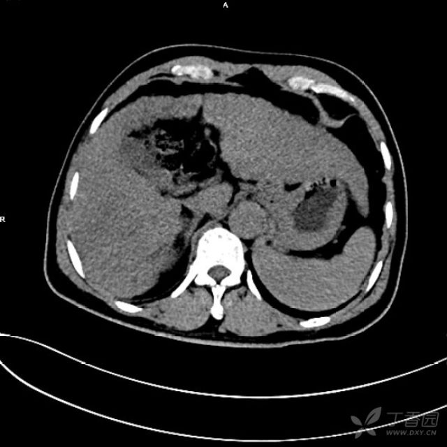 3274011427568305075-8w.jpg!w640