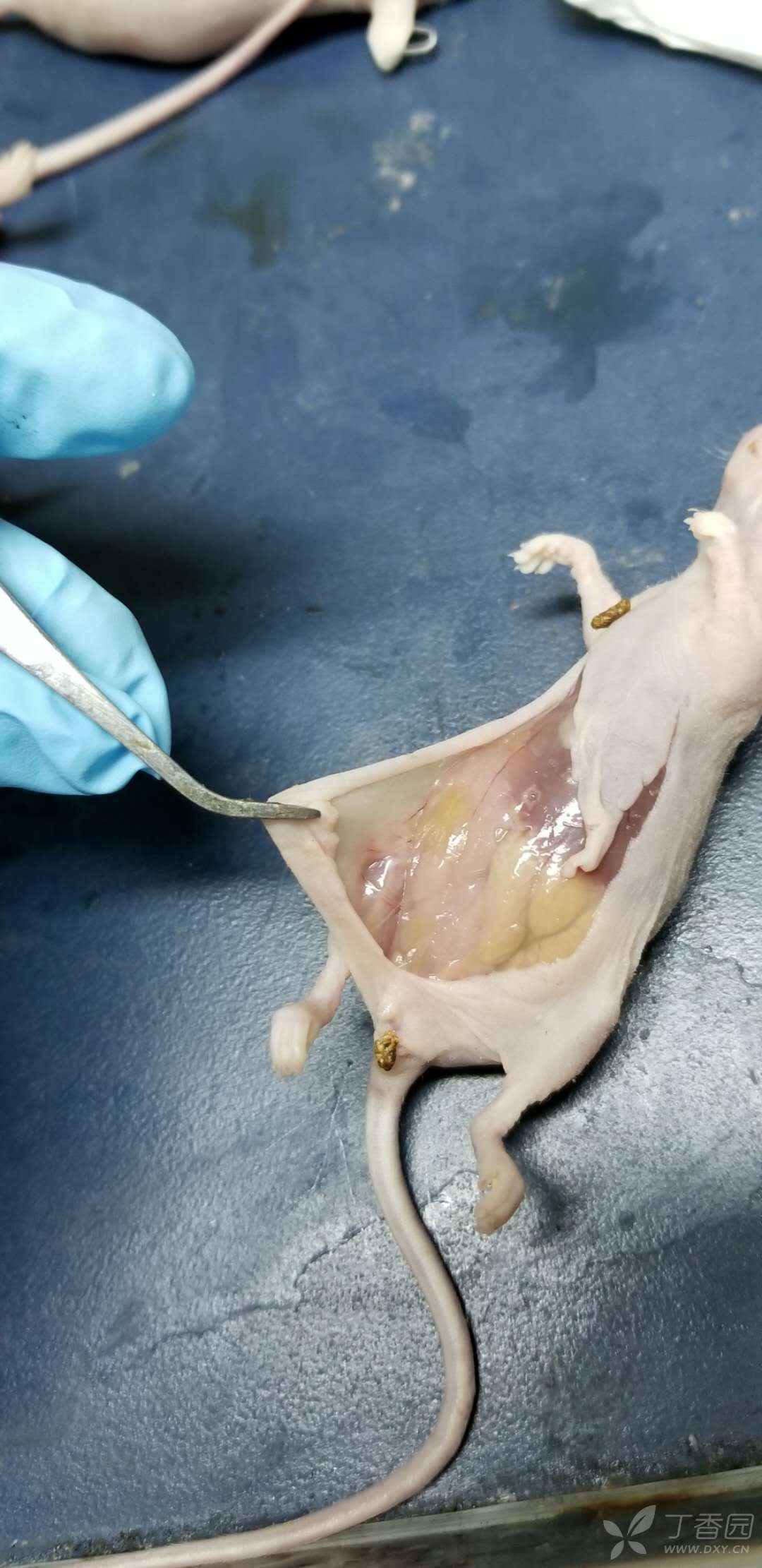 裸鼠乳腺癌,皮下脂肪垫成瘤 - 丁香园论坛