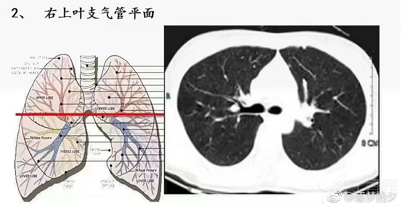 肺上界位置图图片