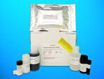 Cytochrome P450 2C8 (CYP2C8) ELISA Kit, Human